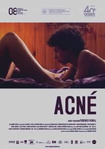 Угри/Acne (2008)